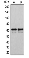 Western blot analysis of Cytochrome P450 2U1 expression in LOVO (A); A2058 (B) whole cell lysates.