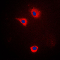 Immunofluorescent analysis of Cytochrome P450 2U1 staining in LOVO cells. Formalin-fixed cells were permeabilized with 0.1% Triton X-100 in TBS for 5-10 minutes and blocked with 3% BSA-PBS for 30 minutes at room temperature. Cells were probed with the primary antibody in 3% BSA-PBS and incubated overnight at 4 C in a humidified chamber. Cells were washed with PBST and incubated with a DyLight 594-conjugated secondary antibody (red) in PBS at room temperature in the dark. DAPI was used to stain the cell nuclei (blue).