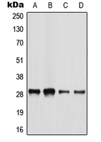 Western blot analysis of BATF2 expression in HeLa (A); HepG2 (B); mouse liver (C); rat liver (D) whole cell lysates.