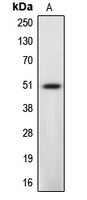 Western blot analysis of Caspase 12 expression in L929 (A) whole cell lysates.