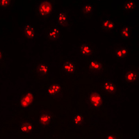 Immunofluorescent analysis of CDYL2 staining in HepG2 cells. Formalin-fixed cells were permeabilized with 0.1% Triton X-100 in TBS for 5-10 minutes and blocked with 3% BSA-PBS for 30 minutes at room temperature. Cells were probed with the primary antibody in 3% BSA-PBS and incubated overnight at 4 C in a humidified chamber. Cells were washed with PBST and incubated with a DyLight 594-conjugated secondary antibody (red) in PBS at room temperature in the dark. DAPI was used to stain the cell nuclei (blue).