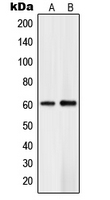 Western blot analysis of PLK5 expression in Jurkat (A); human brain (B) whole cell lysates.