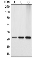 Western blot analysis of APOA1BP expression in HEK293T (A); mouse kidney (B); rat kidney (C) whole cell lysates.