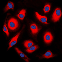 Immunofluorescent analysis of APOA1BP staining in HEK293T cells. Formalin-fixed cells were permeabilized with 0.1% Triton X-100 in TBS for 5-10 minutes and blocked with 3% BSA-PBS for 30 minutes at room temperature. Cells were probed with the primary antibody in 3% BSA-PBS and incubated overnight at 4 C in a humidified chamber. Cells were washed with PBST and incubated with a DyLight 594-conjugated secondary antibody (red) in PBS at room temperature in the dark. DAPI was used to stain the cell nuclei (blue).