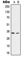 Western blot analysis of RNF113B expression in HepG2 (A); Jurkat (B) whole cell lysates.