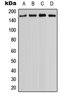 Western blot analysis of MYO3B expression in NCIH460 (A); HEK293T (B); mouse eye (C); rat kidney (D) whole cell lysates.