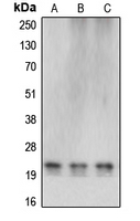 Western blot analysis of Cerebellin 4 expression in HEK293T (A); SP2/0 (B); rat liver (C) whole cell lysates.