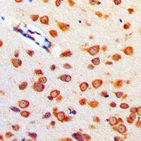 Immunohistochemical analysis of Cerebellin 4 staining in human brain formalin fixed paraffin embedded tissue section. The section was pre-treated using heat mediated antigen retrieval with sodium citrate buffer (pH 6.0). The section was then incubated with the antibody at room temperature and detected using an HRP conjugated compact polymer system. DAB was used as the chromogen. The section was then counterstained with haematoxylin and mounted with DPX.