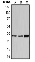 Western blot analysis of CD1e expression in HeLa (A); SP2/0 (B); H9C2 (C) whole cell lysates.