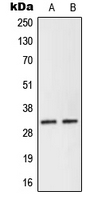 Western blot analysis of NEURL2 expression in Human Placenta (A); KNRK (B) whole cell lysates.