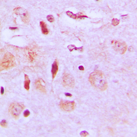 Immunohistochemical analysis of NEURL2 staining in human brain formalin fixed paraffin embedded tissue section. The section was pre-treated using heat mediated antigen retrieval with sodium citrate buffer (pH 6.0). The section was then incubated with the antibody at room temperature and detected using an HRP conjugated compact polymer system. DAB was used as the chromogen. The section was then counterstained with haematoxylin and mounted with DPX.