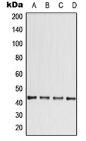Western blot analysis of CCBE1 expression in ACHN (A); HeLa (B); SP2/0 (C); PC12 (D) whole cell lysates.