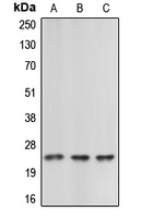 Western blot analysis of Cerebellin 2 expression in HEK293T (A); Raw264.7 (B); rat kidney (C) whole cell lysates.