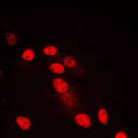 Immunofluorescent analysis of SYNE3 staining in HepG2 cells. Formalin-fixed cells were permeabilized with 0.1% Triton X-100 in TBS for 5-10 minutes and blocked with 3% BSA-PBS for 30 minutes at room temperature. Cells were probed with the primary antibody in 3% BSA-PBS and incubated overnight at 4 C in a humidified chamber. Cells were washed with PBST and incubated with a DyLight 594-conjugated secondary antibody (red) in PBS at room temperature in the dark. DAPI was used to stain the cell nuclei (blue).