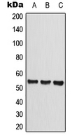 Western blot analysis of CLEC14A expression in HEK293T (A); Raw264.7 (B); rat liver (C) whole cell lysates.