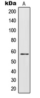Western blot analysis of IL-28RA expression in HepG2 (A) whole cell lysates.