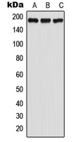 Western blot analysis of GPR125 expression in HeLa (A); SP2/0 (B); PC12 (C) whole cell lysates.
