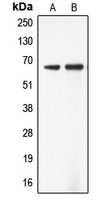 Western blot analysis of ADCK5 expression in Jurkat (A); SW13 (B) whole cell lysates.