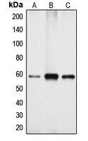 Western blot analysis of Cytochrome P450 4X1 expression in Jurkat (A); mouse kidney (B); rat kidney (C) whole cell lysates.