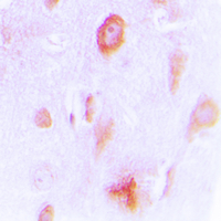 Immunohistochemical analysis of Cytochrome P450 4X1 staining in human brain formalin fixed paraffin embedded tissue section. The section was pre-treated using heat mediated antigen retrieval with sodium citrate buffer (pH 6.0). The section was then incubated with the antibody at room temperature and detected using an HRP conjugated compact polymer system. DAB was used as the chromogen. The section was then counterstained with haematoxylin and mounted with DPX.