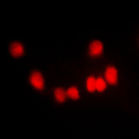 Immunofluorescent analysis of HKR1 staining in NIH3T3 cells. Formalin-fixed cells were permeabilized with 0.1% Triton X-100 in TBS for 5-10 minutes and blocked with 3% BSA-PBS for 30 minutes at room temperature. Cells were probed with the primary antibody in 3% BSA-PBS and incubated overnight at 4 C in a humidified chamber. Cells were washed with PBST and incubated with a DyLight 594-conjugated secondary antibody (red) in PBS at room temperature in the dark. DAPI was used to stain the cell nuclei (blue).