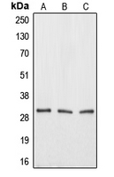 Western blot analysis of Aquaporin 12A expression in HEK293T (A); mouse testis (B); rat kidney (C) whole cell lysates.