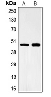 Western blot analysis of FOXB2 expression in Lovo (A); HeLa (B) whole cell lysates.