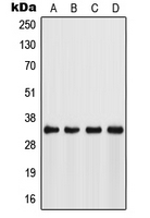 Western blot analysis of FSBP expression in Jurkat (A); HeLa (B); NIH3T3 (C); mouse stomach (D) whole cell lysates.