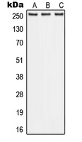Western blot analysis of ABCA1 expression in A549 (A); Raw264.7 (B); PC12 (C) whole cell lysates.