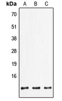 Western blot analysis of FXYD2 expression in HepG2 (A); mouse lung (B); rat brain (C) whole cell lysates.