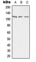 Western blot analysis of PMCA2 expression in HEK293T (A); mouse brain (B); rat brain (C) whole cell lysates.
