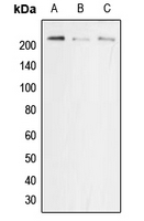 Western blot analysis of p22 phox expression in MCF7 (A); NIH3T3 (B); PC12 (C) whole cell lysates.