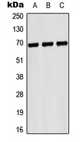 Western blot analysis of CD42b expression in Hela (A); NIH3T3 (B); H9C2 (C) whole cell lysates.