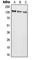 Western blot analysis of NMDAR2C expression in SKOVCAR (A); HEK293T (B); SP2/0 (C) whole cell lysates.