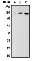 Western blot analysis of MYBPC2 expression in Hela (A); NIH3T3 (B); H9C2 (C) whole cell lysates.
