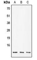 Western blot analysis of POLR2K expression in DLD (A); SP2/0 (B); PC12 (C) whole cell lysates.