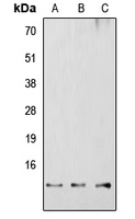 Western blot analysis of RBBP6 expression in HEK293T (A); Raw264.7 (B); H9C2 (C) whole cell lysates.