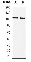 Western blot analysis of CTIP (pS327) expression in HEK293T (A); Raw264.7 (B) whole cell lysates.