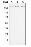 Western blot analysis of ROS (pY2114) expression in SKOVCAR (A); Raw264.7 (B); PC12 (C) whole cell lysates.