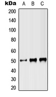 Western blot analysis of ST3N expression in HEK293T (A); NIH3T3 (B); PC12 (C) whole cell lysates.