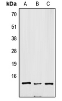 Western blot analysis of SNRPD3 expression in Jurkat (A); mouse brain (B); H9C2 (C) whole cell lysates.