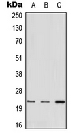 Western blot analysis of MED22 expression in A549 (A); mouse heart (B); rat liver (C) whole cell lysates.