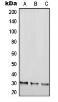 Western blot analysis of RGS20 expression in HEK293T (A); NIH3T3 (B); H9C2 (C) whole cell lysates.