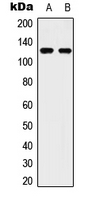 Western blot analysis of ULK2 expression in Hela (A); HepG2 (B) whole cell lysates.