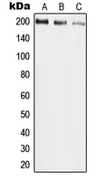 Western blot analysis of UBR2 expression in HepG2 (A); mouse liver (B); rat liver (C) whole cell lysates.