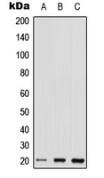 Western blot analysis of TC10 expression in HEK293T (A); Raw264.7 (B); H9C2 (C) whole cell lysates.