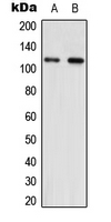 Western blot analysis of NNT expression in HEK293T (A); NIH3T3 (B) whole cell lysates.