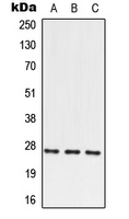 Western blot analysis of PRRX2 expression in HEK293T (A); SP2/0 (B); PC12 (C) whole cell lysates.