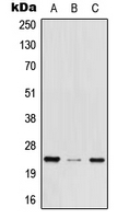 Western blot analysis of MED29 expression in HEK293T (A); mouse brain (B); rat lung (C) whole cell lysates.