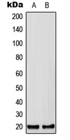 Western blot analysis of CFC1B expression in HEK293T (A); Raw264.7 (B); H9C2 (C) whole cell lysates.